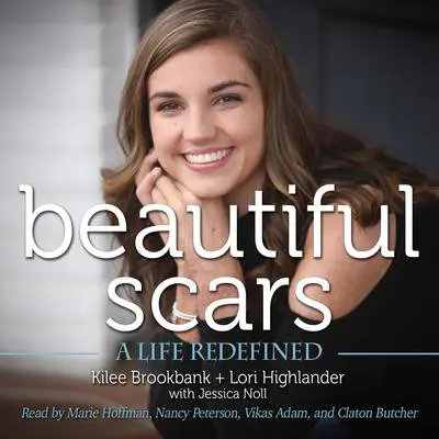 Beautiful Scars: A Life Redefined Audibook, by Kilee Brookbank